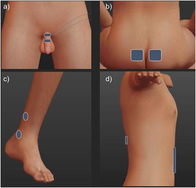 A Urodynamic Comparison of Neural Targets for Transcutaneous Electrical Stimulation to Acutely Suppress Detrusor Contractions Following Spinal Cord Injury